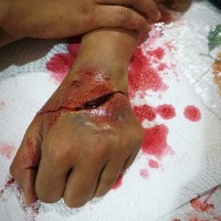 mini thumb